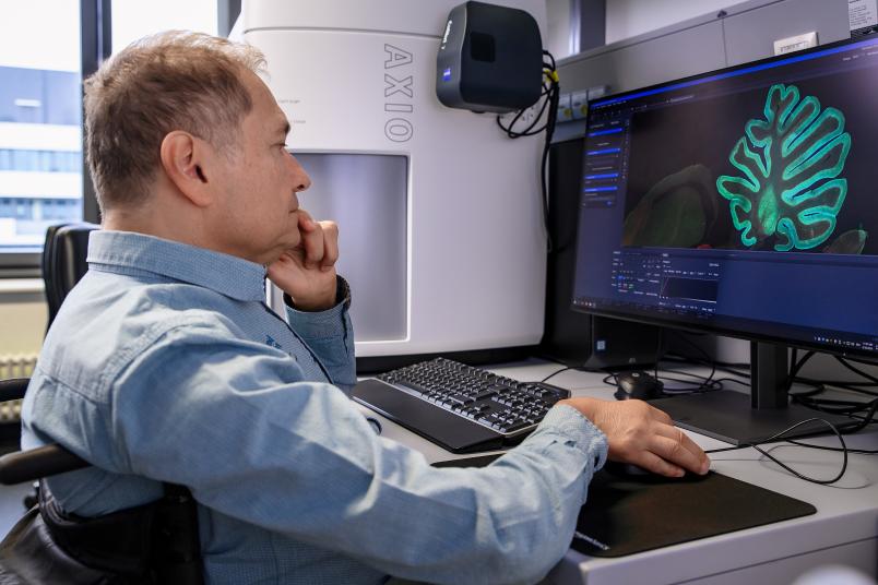 Alison Hanniganning yalangoch yulduzlari